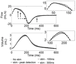 Figure 3.   Example of 15 flow curves overlap (top) without and (bottom)  with stimulation, with a 100ms-delay