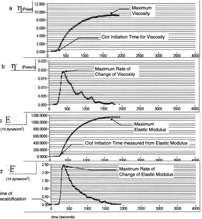 Figure  5. Sample  data  chart  of a  normal  volunteer's  whole  blood viscoelasticity vs