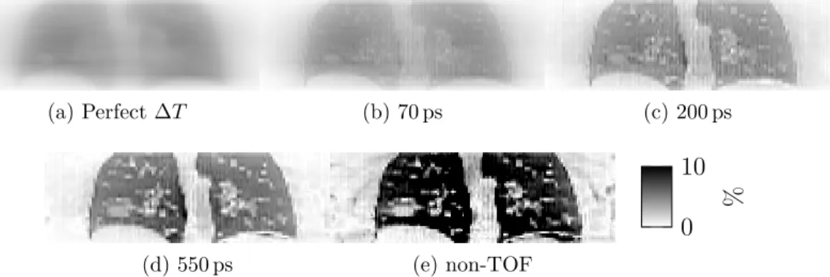 Figure 6: Simulation 2 (Lung density changes only ) – Relative difference images RD λ , in coronal view (a) expected at perfect time resolution and for four reconstructions with different TOF resolution: (b) 70 ps, (c) 200 ps, (d) 550 ps and (e) non-TOF.