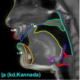 Figure 1: Articulator contours superimposed on a midsagittal image of /ɭ/ in /aɭa/ (speaker KD)