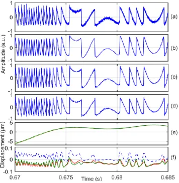Fig. 8. Experimental signals for f PZT  = 40Hz: (a) experimental noisy  SMI  signal  picked  up  by  DL7140,  (b)    SM  signal  recovered  with  RLS-ALE,  (c)    LPF,  (d)  DWT,  (e)    D r  (t)  retrieved  by  PUM,  (blue  (D PZT (t)), yellow dotted (RLS