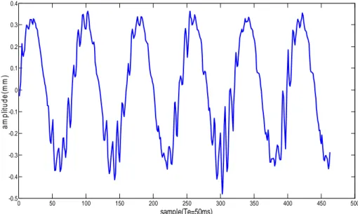 Figure 2: residual motion estimated by ultrasound imaging for a 1D motion of 2.3 mm of  amplitude 