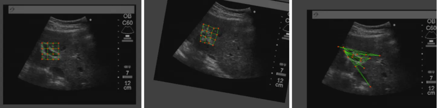 Figure 1: Results estimated on real data. (Left) Template tracking with mass-spring system at initialization (frame 1)
