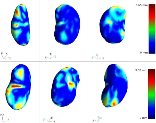 Figure 2. Distance map of two intermediate kidney models obtained by mesh morphing for two given breathing  phases
