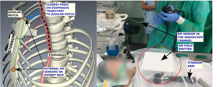 Fig. 1: Placement of sensors (left) and System setup (right)