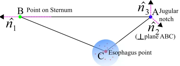 Fig. 2: Forming the reference frame for inter-operative registration.