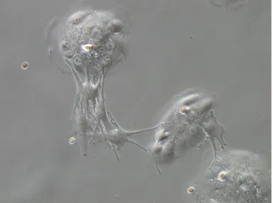 Figure 1.8  Kératinocytes et mélanocytes humains en primo-culture (grossissement x20, sujet sain, collection personnelle)