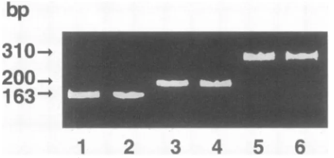 FIG. 4. Agarose gel showing different sizes of PCR products am-