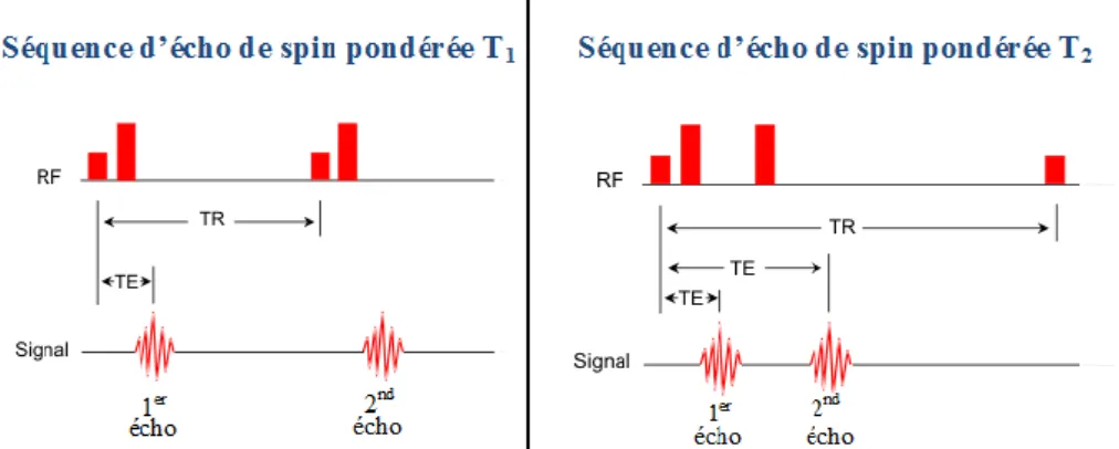 Figure 1.4 : Représentation des séquences d’écho de spin utilisées pour l’obtention d’images  pondérées T 1  et T 2  [9]