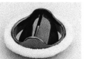 Figure  5:  Bjork-Shiley tilting disc valve design.