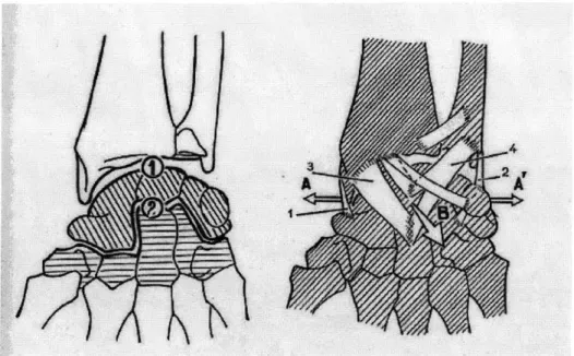 Figure  2-4:  Drawings  depicting  the  bone  and  ligament  structure  of  the  articular complex  of  the  wrist  [31].