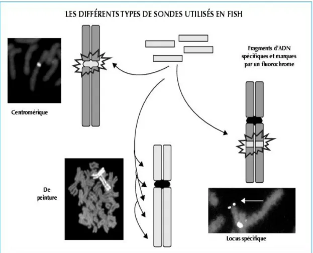 Figure 5 : Les différentes sondes utilisées en FISH [Lemieux et al., 1994]