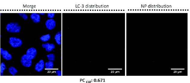 Fig. 3 Detection of autophagy inside NP-treated Calu-3 cells. Calu-3 cells were exposed to 16 nm SiO 2 -FITC-NPs at 5 μg  cm −2  for 24 h