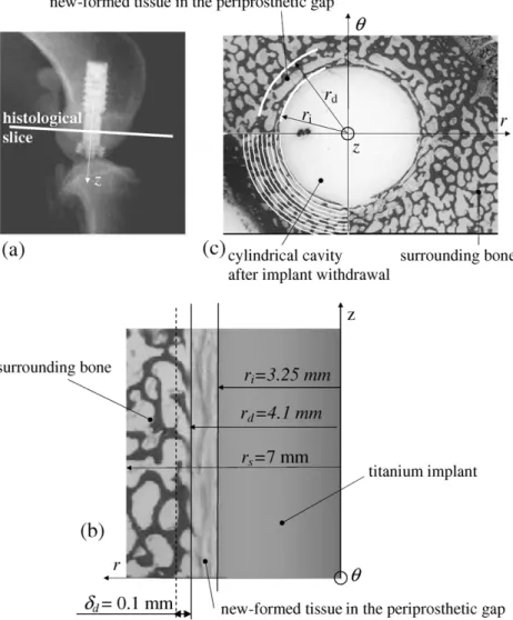 Fig. 3. Canine implant (Søballe et al., 1992): (a) in-vivo implantation (x-ray), (b) axisymmetric model, (c) histological slice showing the biological tissue distribution.