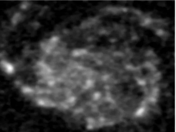 Figure 2: Restoration results for image ¯ x 1 using WL2 approximation.