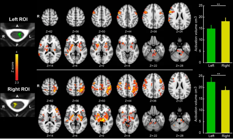 Fig 2. The spinal hemicords are preferentially connected to the contralateral cerebral cortex at rest