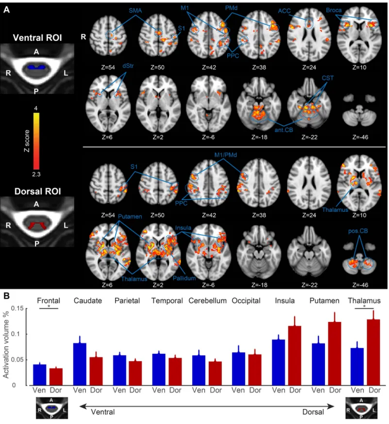 Fig 3. Distinct resting-state brain connectivity associated with the ventral and dorsal horns of the spinal cord
