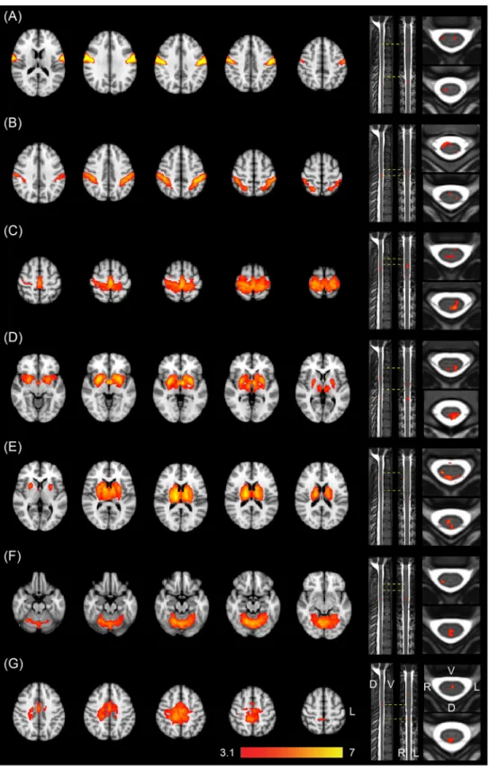 Fig 4. Joint ICA of brain and spinal cord RSNs. ICA revealed 7 distributed networks that include both brain and spinal cord clusters