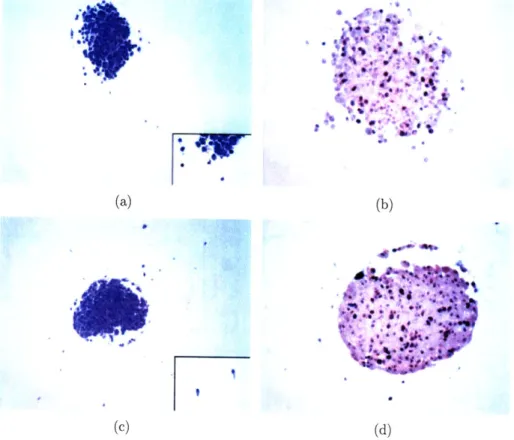 Figure  2-3:  Histopathology  findings,  comparing  14T  MTS  with  control.  (a).  H&amp;E staining  of  14T  specimen  (original  magnification  x1OO)  showing  only  a  small   num-ber  of  cells  infiltrating  the  gel