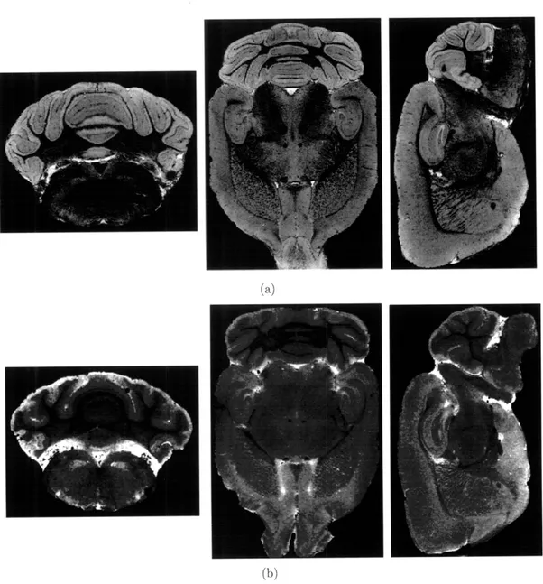 Figure  3-4:  high-resolution  MRM  of  ex  vivo  mouse  brain  stained  with  5  mM  Gd- Gd-DTPA 2  (a)  or  0.36  mM  MnCl  (b)  reveals  detailed  anatomical  structure  with  different image  contrast  in  certain  regions  brain,  e.g.,  cerebellum,  