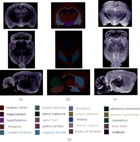Figure 3-5:  high-resolution  MRM of  ex vivo  mouse brain  stained with 0.24 mM  MnC12 (a)  or  5 mM  Gd-  DTPA  (b)  reveals detailed  anatomical  structure  with different  image contrast  in  certain  regions  brain,  e.g.,  cerebellum,  cortex,  and  