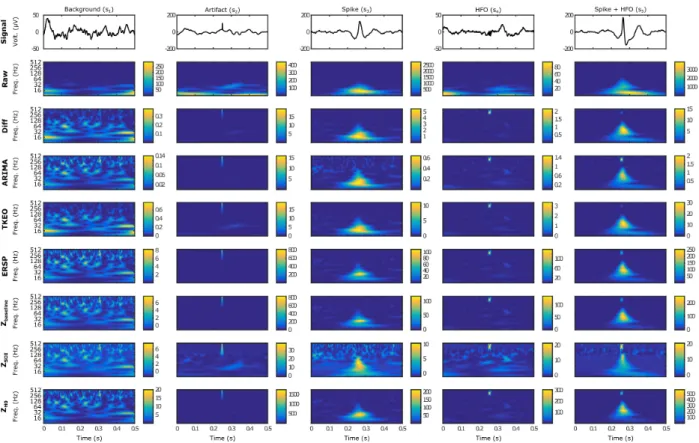 Figure II.4. – Examples of the 5 types of simulated events in time and time-frequency domains.