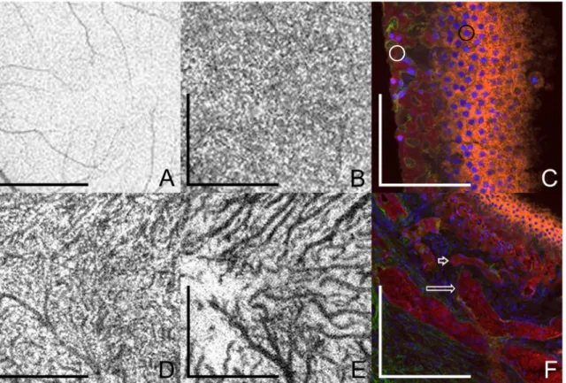 Fig 1. Enface swept-source optical coherence tomography (SS-OCT) describing the choroidal layers in a normal 40-year-old subject and post- post-mortem histological examination of the choroid in an 81-year-old subject