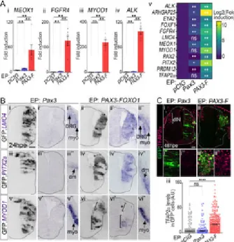 Fig 3. PAX3-FOXO1 converts embryonic neural progenitors into cells harbouring FP-RMS molecular traits.