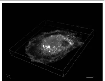 Figure 2 Immunofluorescent staining of Gag in a HIV-1-infected  macrophage. Monocyte-derived-macrophages were infected with  HIV-1 NLAD8 pseudotyped with VSV-G