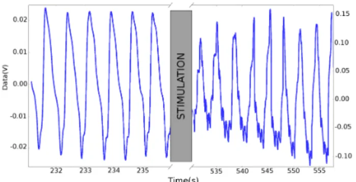 Figure 1. In vivo optical transmittance ver- ver-sus wavelength of the pig’s SC before laminectomy (Case 1) and after (Case 2).