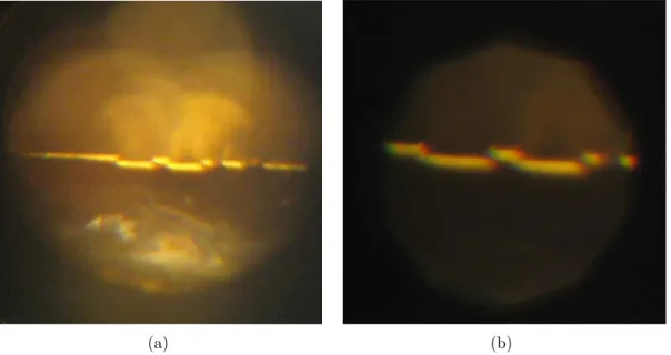 Figure 4-4: Pictures of 20 µm ridge facet as seen through objective. (a) Aperture completely open (b) Aperture partially closed, zoomed in.