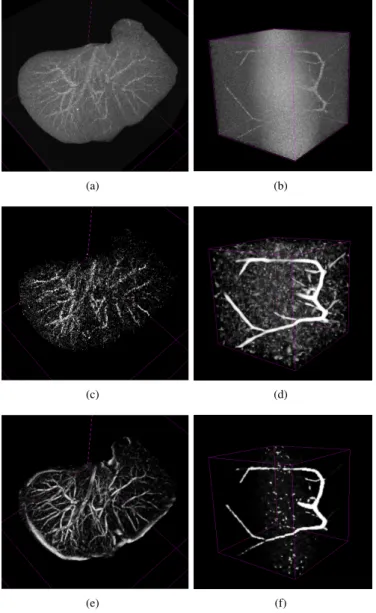 Fig. 4. Illustration of the best methods on the Ircad dataset (a,c,e) and the VascuSynth dataset (b,d,f)