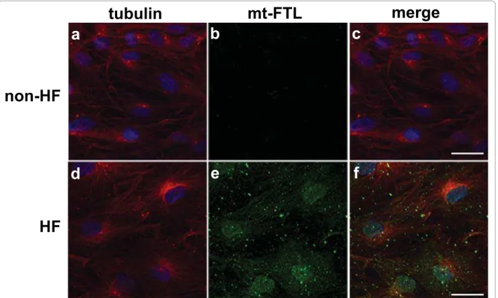 Figure 1 Accumulation of ferritin in cultured HF skin fibroblasts. Confocal immunofluorescence microscopy was performed on cultured confluent wild-type (non-HF) (a-c) and HF (d-f) fibroblasts using antibodies against alpha-tubulin (a, d) and mutant FTL (b,