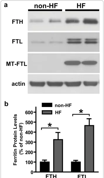 Figure 2 Increased levels of ferritin polypeptides in HF skin fibroblasts. a) Representative western blot showing the expression of ferritin subunits in non-HF and HF fibroblasts