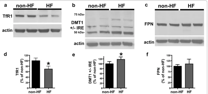 Figure 3 Expression of proteins of iron metabolism. Representative western blots showing the expression of: a) TfR-1, b) DMT1 (+/-) IRE, and c) FPN, in non-HF and HF fibroblasts