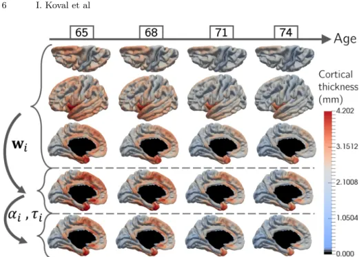 Fig. 2: Cortical thickness at 65, 68, 71 and 74 years old of the mean propaga- propaga-tion (first rows)
