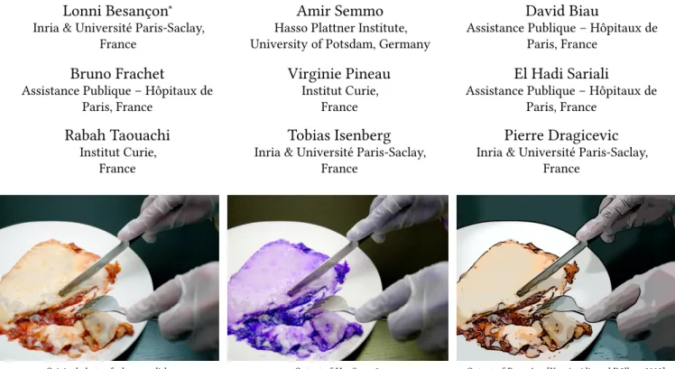 Figure 1: Two techniques studied in this article, each using a different strategy for making surgery images easier to look at.