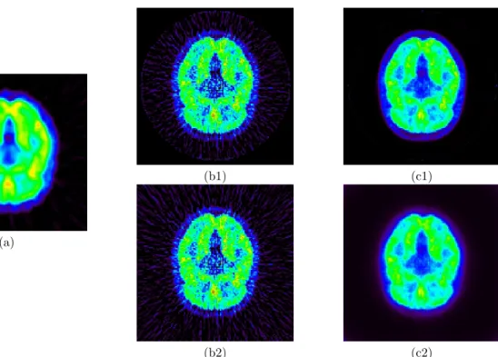Figure 4. A numerical brain model associated with a FDG functional model is used by the Monte Carlo based PET simulator PET-SORTEO to generate simulated PET data