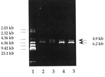 Figure 1.3  Restriction digest pattern  with HindIII.  Lane  1 contains  the molecular size  markers (HindIII digest of X DNA)