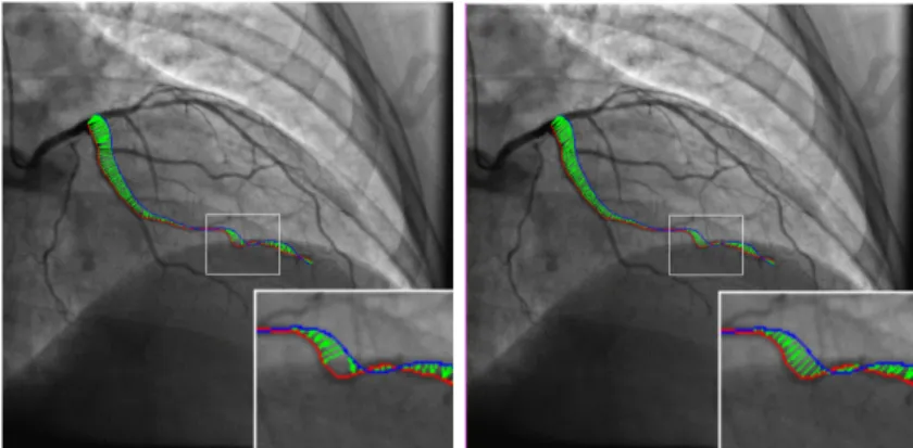 Fig. 1 shows the pairings obtained with this weighted Fr´ echet distance. It is especially useful when the two curves to be paired have experienced a  non-rigid transformation with respect to each other