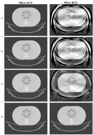 Fig. 3. Water volumes at 100 iterations, slice 6/11 is the central slice and slice 8/11 is the last top slice in FOV (cf Fig