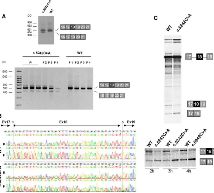 Fig. 1 The c.5242C [ A variant is associated with aberrant splicing of BRCA1 exon 18. a RT-PCR analysis of exon 16–21 of BRCA1 on family 1 proband and cancer-free control patient RNA (upper gel) or on RNA extracted from blood patients samples belonging to 