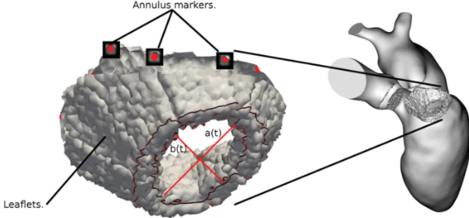 Fig. 2 Left plot: annulus markers and grid cells where a body force is added to model the MV leaflets