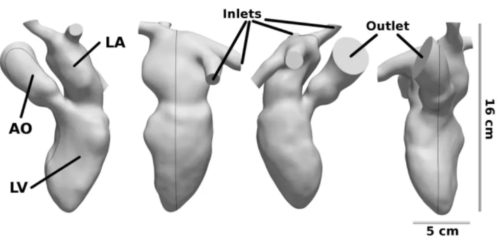 Fig. 3 Template computational domain extracted from a 3D medical image. The same domain is represented for four different points of view and the left ventricle (LV), left atrium (LA) and Aorta (AO) are indicated