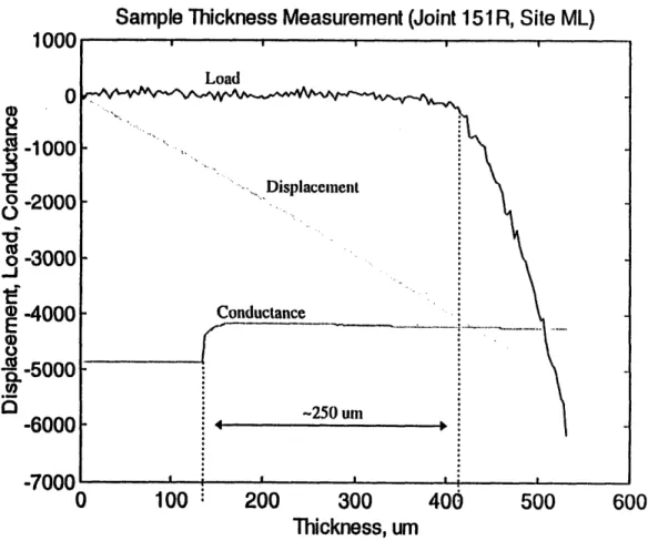 Figure  2.4:  Representative  thickness measurement  for right joint  151  at the middle lateral site.