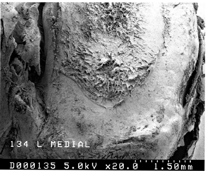 Figure  1.1  An scanning  electron  micrograph  of the tibial plateau  from a  guinea pig joint.