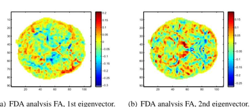 Fig. 2 Entire brain. FA segment of the FDA weights vectors (w 1 FA , w 2 FA ) for λ = 400.