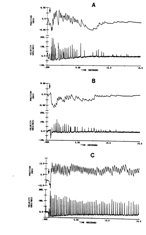 Figure  2.4.  Post-rotational  torsion  responses  to  100*/s  off-velocity  step stimuli  in  man