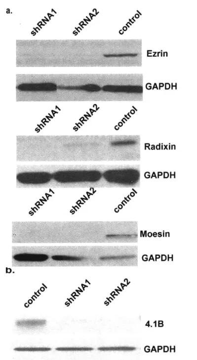 Figure  2:  Knock down of FERM-domain-containing  proteins in murine  mammary  carcinoma a