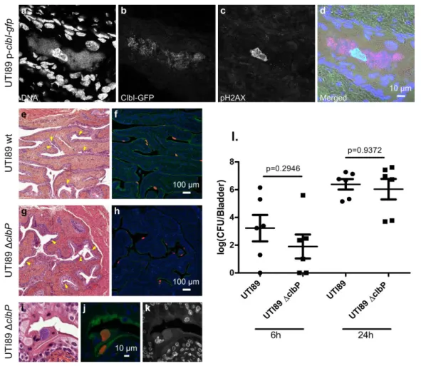 Fig.  4:  Colibactin  is  produced  during  UTIs  and  induces  DNA  damage.  a-d.  Confocal  520 